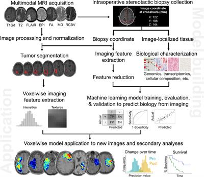 An image-based modeling framework for predicting spatiotemporal brain cancer biology within individual patients